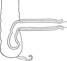Intussusception diagram intended to show the relation of the several parts, vintage engraving. vector
