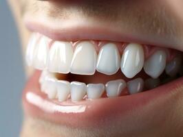 ai generado un hombre sonriente con su dientes bien recortado foto