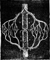 Figure schematic explaining the collateral circulation that deve vector