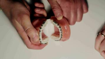 installatie van orthodontisten. de tandarts demonstreert de installatie van een beugel Aan de tandheelkundig model. de tandarts maatregelen de afstand van de orthodontisch een beugel. video