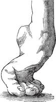 Equine clubfoot, vintage engraving. vector