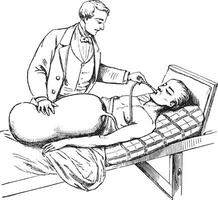 Device Limousin to administer the oxygen in cases of asphyxia by vector