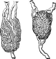 Lymph nodes, vintage engraving. vector