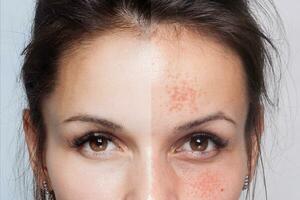 antes de y después cosmético operación. joven bonito mujer retrato foto