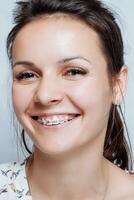 Young woman portrait with dental braces natural photo