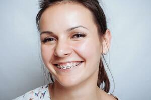 Young woman portrait with dental braces natural photo