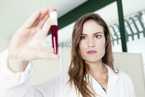 female doctor examines blood tube in laboratory photo