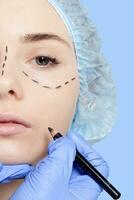 Beautiful young woman perforation lines plastic surgery operation photo
