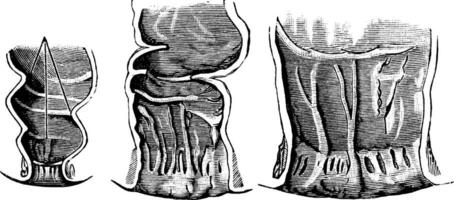 Development of the Anal Cavity, vintage illustration. vector