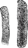 Epithelial casts, vintage engraving. vector