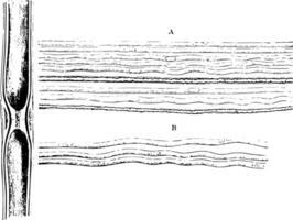 Gelatinous Nerve Fibers vintage illustration. vector