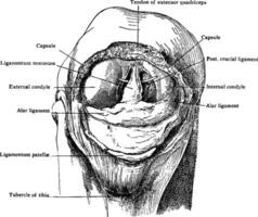 Patella Removed from Knee, vintage illustration. vector