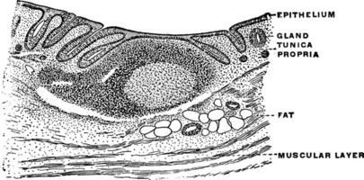 Transverse Section of Appendix, vintage illustration. vector