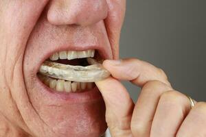 Older Mature Man putting in a night Guard in his mouth to prevent grinding photo