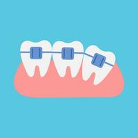 Teeth with braces on a blue background. Flat style. Vector