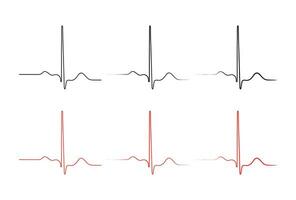 Ventricular repolarization, Cardiac cycle, ECG of heart in normal sinus rhythm, QT interval of ECG. vector