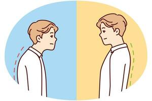 Comparison of man with good and bad back posture. Male suffer from scolisosis from sedentary work. Vector illustration.