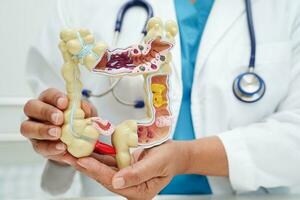 Intestine, doctor holding anatomy model for study diagnosis and treatment in hospital. photo