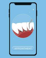 Professional teeth cleaning vector illustration. Book an appointment for teeth cleaning