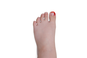 The big toe was injured and bleeding PNG transparent
