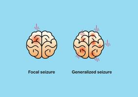 Illustration of seizure types demonstrating by onset and brain waves. vector