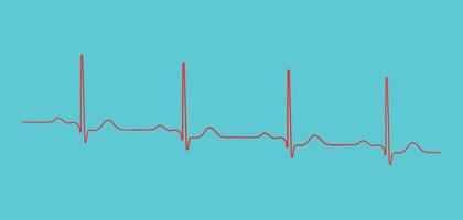 Ventricular repolarization, Cardiac cycle, ECG of heart in normal sinus rhythm, QT interval of ECG. vector