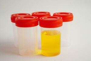 Urinalysis, urine cup for check health examination in laboratory. photo