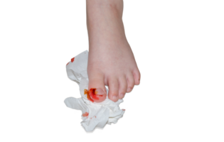 The big toe was injured and bleeding PNG transparent