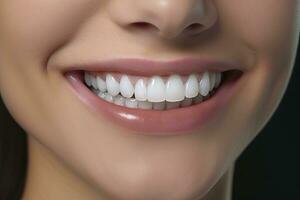 AI generated Close up of a smile with nice white teeth. AI Generated photo