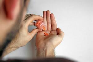 un hombre sostiene en su mano un parte de pastillas para tratamiento. foto