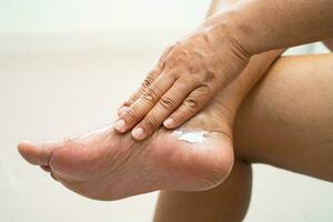 Asian woman care feet with cracked and dry heel skin cream at home. photo