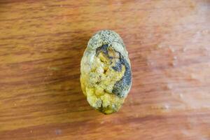 Large gallstone, Gall bladder stone. The result of gallstones photo