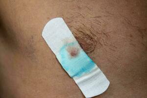 Bactericidal adhesive tape on the male nipple photo