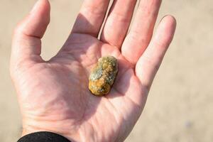 Gallstone in hand, Gall bladder stone. result of gallstones. Calculus of heterogeneous composition photo