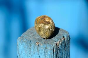 Gall bladder stone. Calculus of heterogeneous composition photo