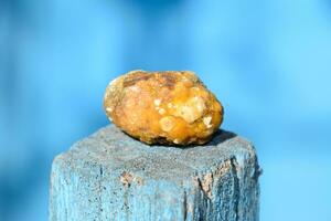 Gall bladder stone. Calculus of heterogeneous composition photo