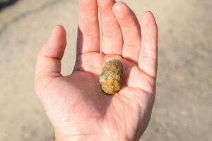 Gallstone in hand, Gall bladder stone. result of gallstones. Calculus of heterogeneous composition photo