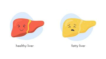 Stages of nonalcoholic liver damage. Healthy, fatty, steatosis, NASH, fibrosis, cirrhosis, cancer. Medical infographic of Liver Disease. Vector banner in flat cartoon style on white background.