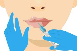 Lip augmentation and correction. Lip filler injections. Hyaluronic acid. Cosmetology procedure vector