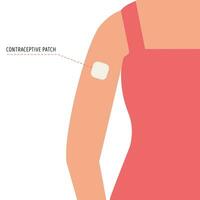 anticoncepción método. vector plano hembra brazo con anticonceptivo parche. nacimiento controlar para mujer y el embarazo prevención. ilustración.