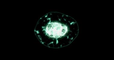 Microscopic view of mitosis, division or reproduction cell video