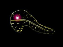 Vector isolated illustration of pancreas with neon effect. Pancreatic pain. Pancreatic cancer.