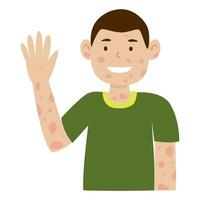 man with leprosy disease smile and arms raised vector