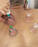 Shot of the female doctor in uniform against the white wall examining mid age male patient, performing cupping therapy. Healthcare photo