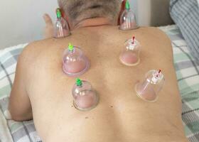 Shot of the female doctor in uniform against the white wall examining mid age male patient, performing cupping therapy. Healthcare photo