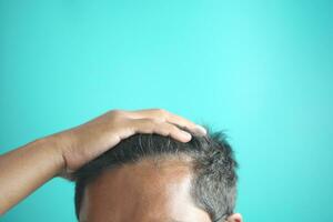 hair loss concept with man checking his hair photo