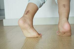 low angle view of A child walking on tiptoes photo