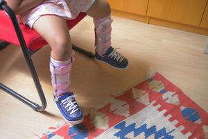 Child cerebral palsy disability with legs orthosis shoes sitting on a chair photo