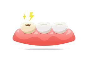 doloroso caries en chicle. dental salud concepto. vector ilustración.