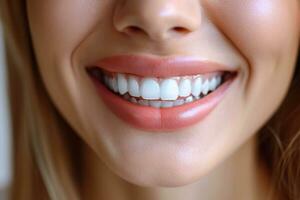 AI generated Closeup view of smiling young woman with whitening teeth. Generative AI. photo